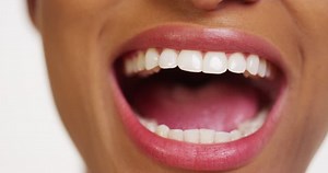 Mouth Teeth Black Woman Dental Examination Stock Footage Video (100% Royalty-free) 7266421 | Shutterstock
