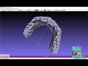 Cerik3D- Meshlab conversion de archivo OBJ a STL en modelos dentales
