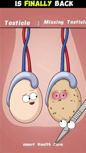 Where Did His Other Testicle Go? #smarthealthcare #healtheveryday #health