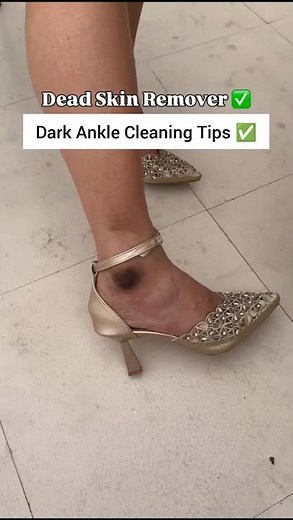 Dark Skin Remover/😳 Clean All Dirt & Tanning | #shorts #ytshorts #dark #hack #beauty #viral