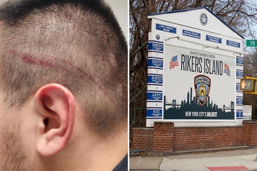 Exclusive | NYC correction officers union calls for Rikers security chief to be fired after another slashing attack
