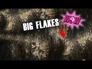 Satisfying Dandruff Scratching - Psoriasis Scalp Scratching Big Flakes