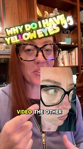 72K views · 1.6K reactions | Gilbert syndrome is a common, harmless...