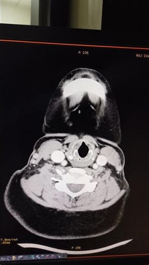 #ctscancect neck 🧣 ,#medicalimaging #anatomy #ctscan #medicaltest #flute #music