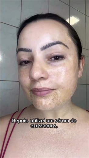 Facial protocol with dermaplaning + plasma jet #esthetician