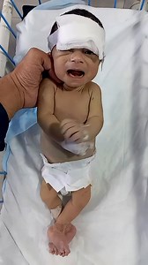 Abdominal Distension in NICU _ Baby’s Condition Unstable – Critical Monitoring Ongoing 🩺 #nicucare #baby #cutebaby #newbornbaby #happiness #nicubaby #babycare #babyrecovery #shorts #cute | Gautam Ashish