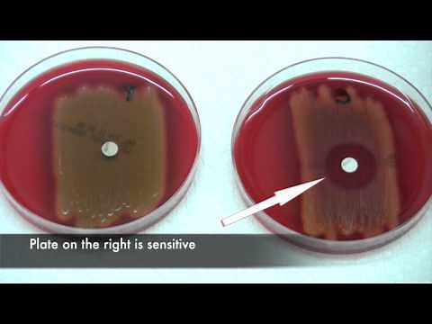 Bacitracin test for Streptococcus pyogenes