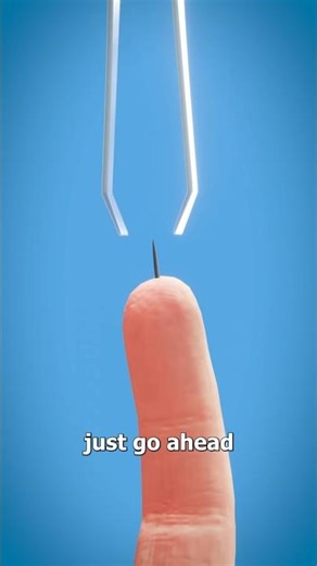 "How Your Body Pushes Out Deep Splinters Naturally #HealthFacts #BodySecrets"