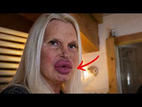 10 Celebrities Who Ruined Their Faces With Plastic Surgery 😱 | Then vs Now 2026