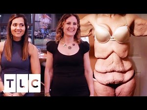 Stephanie And Her Mum Go On Their Skin Removal Journey Together | My Extreme Excess Skin