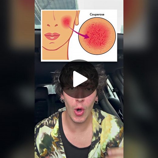 Video di Er.gennaro (@er.gennaro) con suono originale - Er.gennaro