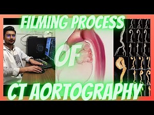 How to make Films of CT Scan Aortography/ Aortogram/ Aortic Angiography #radiologytechnologist