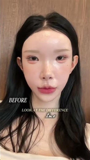 Koreas newest beauty obsession perfecting their silhouettes with ear & shoulder filler 😮💉 I wen...