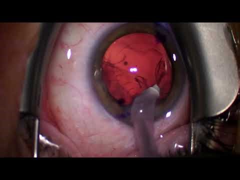 2025 09 10 102941 Vivity