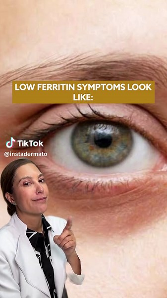 Signs of Low Ferritin Levels and Health Impacts