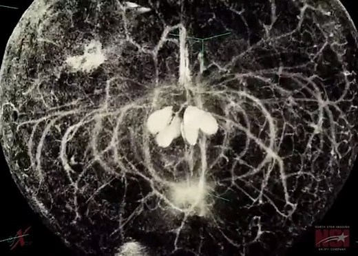 177K views · 4.1K reactions | The structure inside an apple reveals the flower it unfolded from. What else do you see? Video Credit: https://gfycat.com/ampletimelyislandwhistler | Jain 108 Academy | Facebook