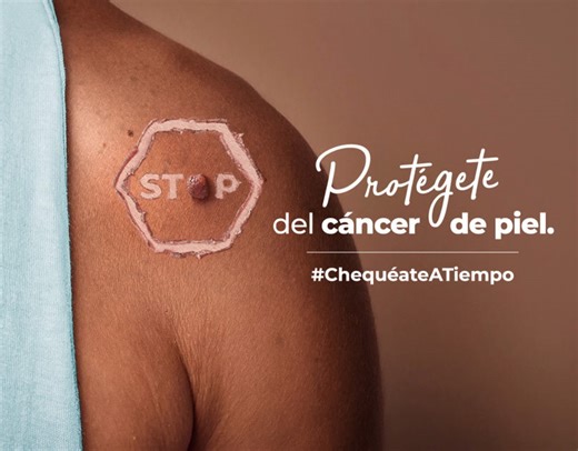 Oncosalud-Cancer-de-Piel