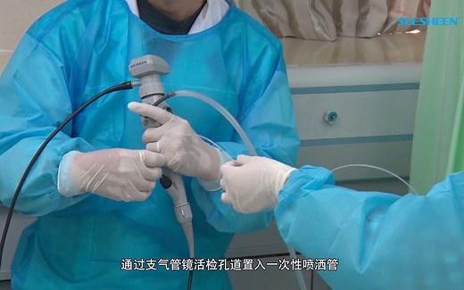 支气管镜肺泡灌洗