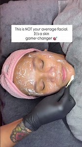Advanced Facial for Acne & Texture 💎
