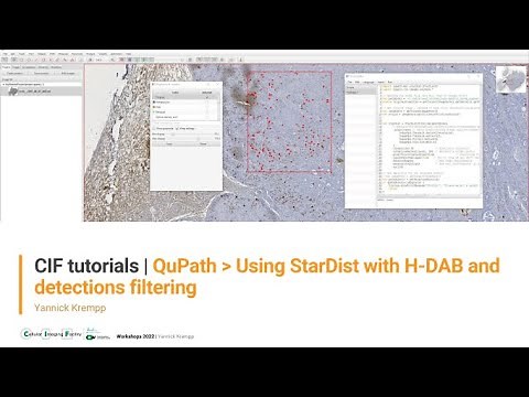 CIF Tutorials | QuPath : Using StarDist with H-DAB images and detections filtering