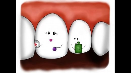 miradent Mira-2-Ton® Lösung 10 ml | zum Einfärben als Plaquetest vor dem Zähneputzen | macht Zahnbelag sichtbar | bewährt | zuverlässig | motivierend | Einfache Anwendung | Erythrosin- und glutenfrei