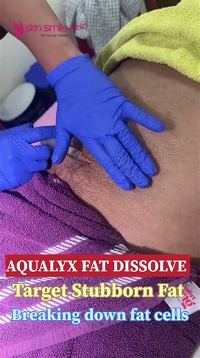 AQUALYX FAT DISSOLVE injection Skin Smile Clinic Bhopal #fatloss #bhopal #skincare
