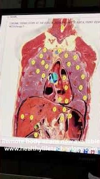 Watch Danielle's Body Scan and Corrective Frequency Set at USA Med Bed 2026! #bodyscan #bodyscanner