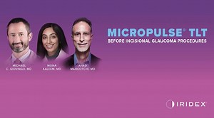 MicroPulse Transscleral Laser Therapy in Combination With Other Glaucoma Treatments - Eyetube