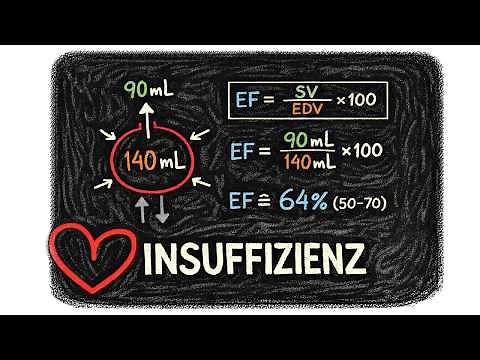 Systolic vs. Diastolic Heart Failure Explained Simply