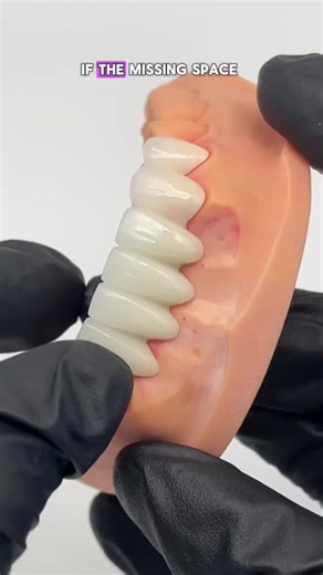 Want to get a price list,please contact my WhatsApp: 86-15393729102, WhatsApp link: http://wa.me/8615393729102, our sale coworker will tell you more details, like brochure...#dentist#dentallab#teeth#denture #dentaltreatment #3Dprinter #Thefastestlaboratory #crowns #Dentalimplant #Zirconiacrown #PFM #CAD #CAM