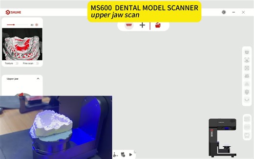 MS600 scan upper jaw #dentallab #SHUHEDental #dentallabscanner #dental #CADCAM