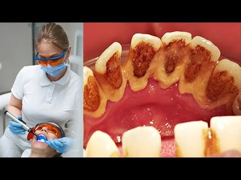 Exploring a Tooth Under a Microscope - Dental Science Revealed