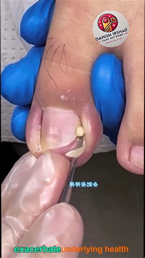 66K views · 470 reactions | 916. Safe sleep-optimization tips tailored for older adults #SleepWellness #OlderAdultWellness #HealthyLiving | Danish irshad fans | Facebook