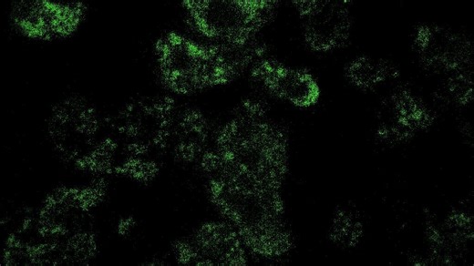 Starved Dictyostelium_ER lumen