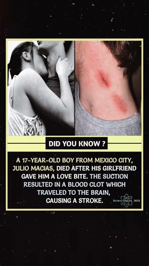 This “Love Bite” Turned DEADLY?! 😨⚠️ #didyouknow #usa #shorts
