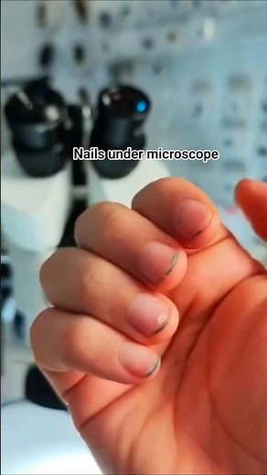 Nails under microscope🔬full video⬆️#microbee#nailsundermicroscope#microscope#viral#germs#explorepage