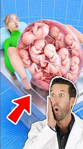 ER Doctor REACTS to Giving Birth on a Spinning Table (Zack D. Films Parody Zeck Felms)
