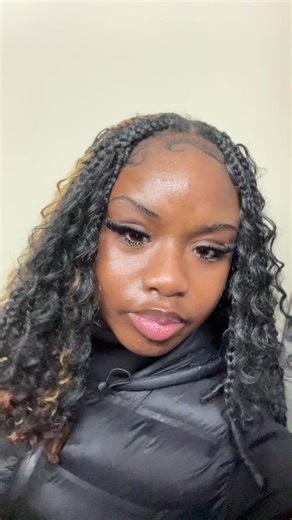 Achieve Perfectly Aligned Teeth for a Confident Smile