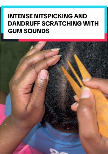 #viral #fyp #scalptreatment #asmr #creator | asmr