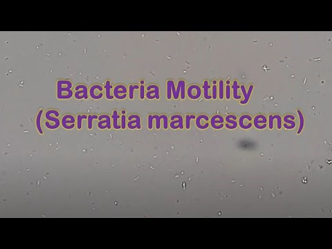 Bacteria Motility | Serratia marcescens