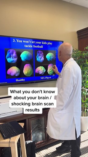 Understanding Different Types of Brain Scans