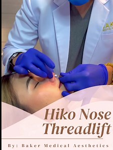 53K views · 245 reactions | Hiko Nose Threadlift HIKO nose lifting...