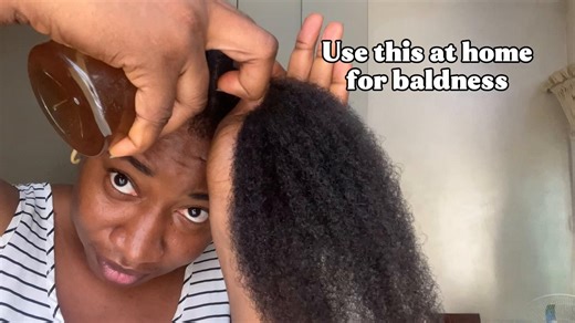 Effective DHT Blockers for Home Hair Growth