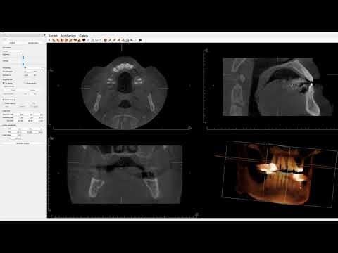 Invivo Anonymizing, Laying and Viewing an Egg