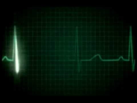 Heartbeat flatline YouTube