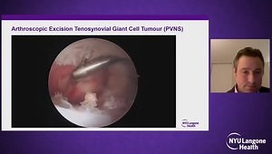 Advanced Techniques in Hip Arthroscopy