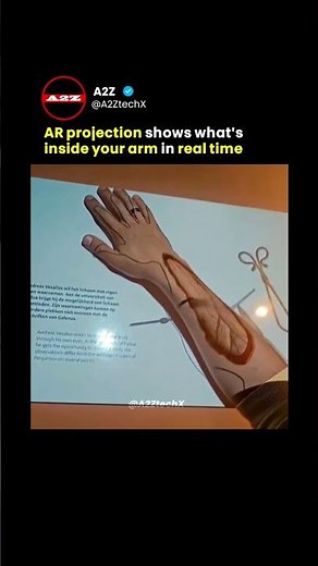 AR projection shows what’s inside your arm in real time
