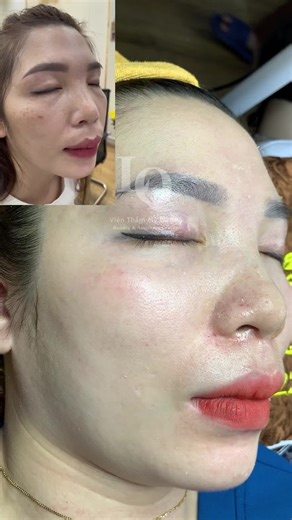 Comprehensive Guide to Chamsoc Daanam Care