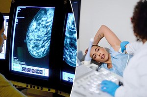 AI can detect breast cancer as well as two doctors: new study