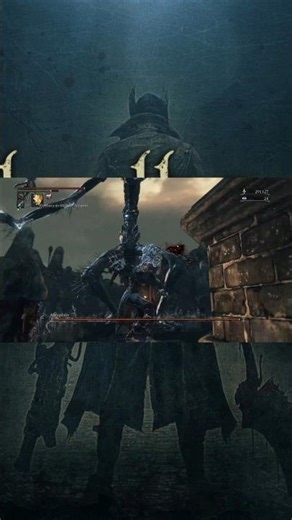 AMYGDALA - BLOODBORNE